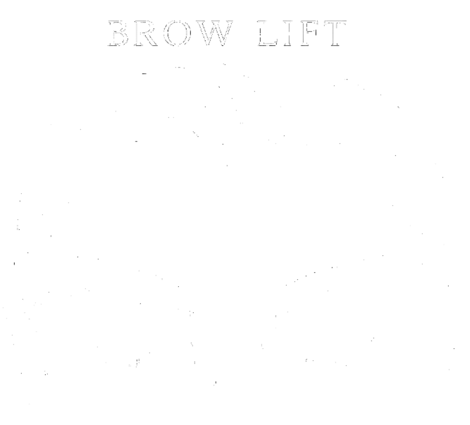 Brow lift